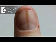 Video thumbnail for What can cause red thick line beneath the thumbnail? - Dr. Aruna Prasad