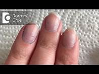 Video thumbnail for What causes bluish discoloration of nail beds? - Dr. Rashmi Ravindra
