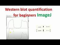 Video thumbnail for Quantification of western blot using imageJ for beginners | western blot quantification | imagej |