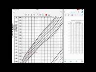 Video thumbnail for How to interpret BP chart in pediatric age group? MedEd series 1
