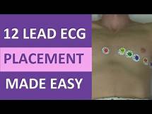 Video thumbnail for 12 Lead ECG Placement Made Easy Nursing EKG Electrodes Interpretation