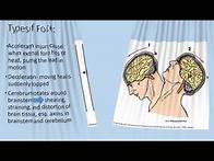 Video thumbnail for Emergency & Trauma Nursing TBI