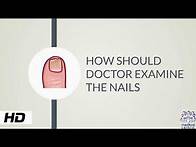 Video thumbnail for HOW AND WHY SHOULD DOCTOR EXAMINE THE NAILS?