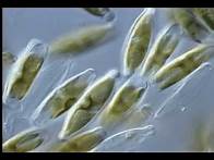 Video thumbnail for Diversity of Protists